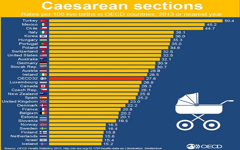 «Βιομηχανία» γεννήσεων με όχημα τις καισαρικές