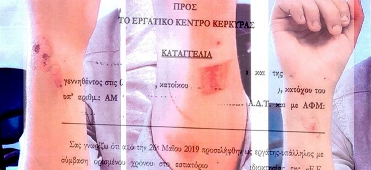Μεσαιωνικά βασανιστήρια με καυτό λάδι σε ασκούμενο μάγειρα